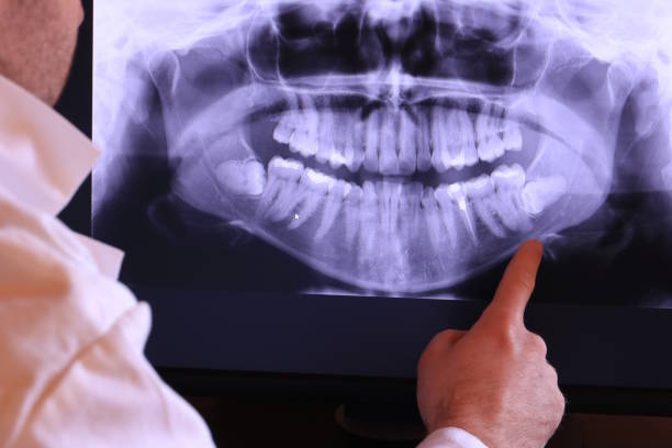 Best Walk-In Emergency Dentist in West Conshohocken, PA